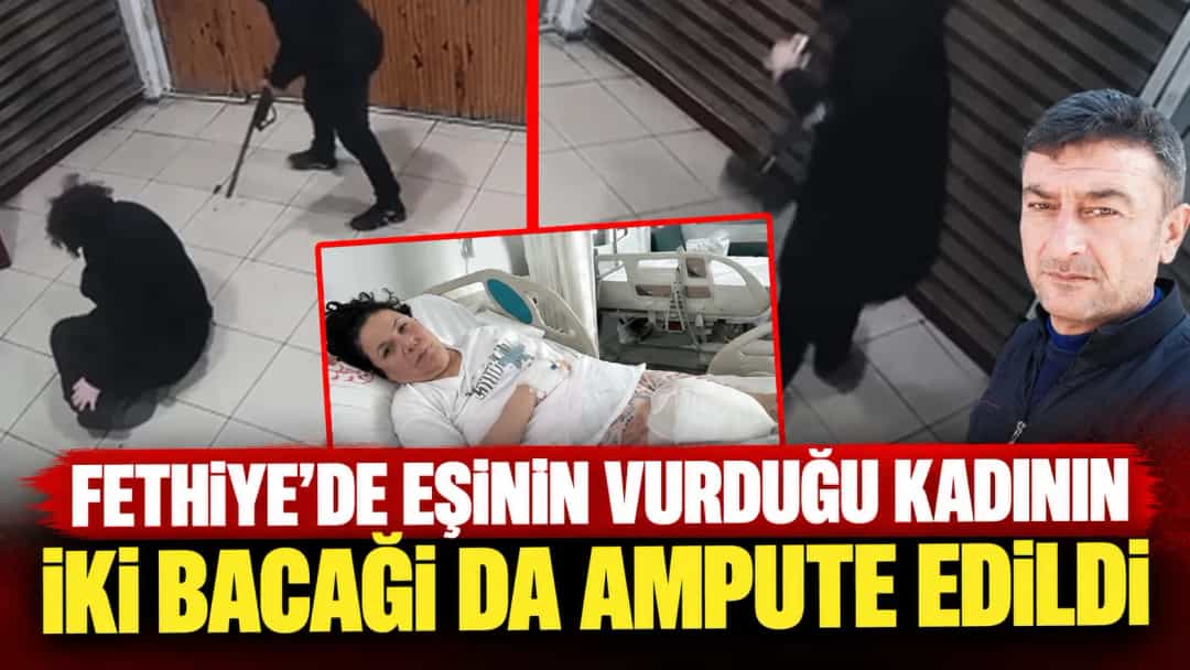 Fethiye’de eşinin vurduğu kadının iki bacağı da ampute edildi