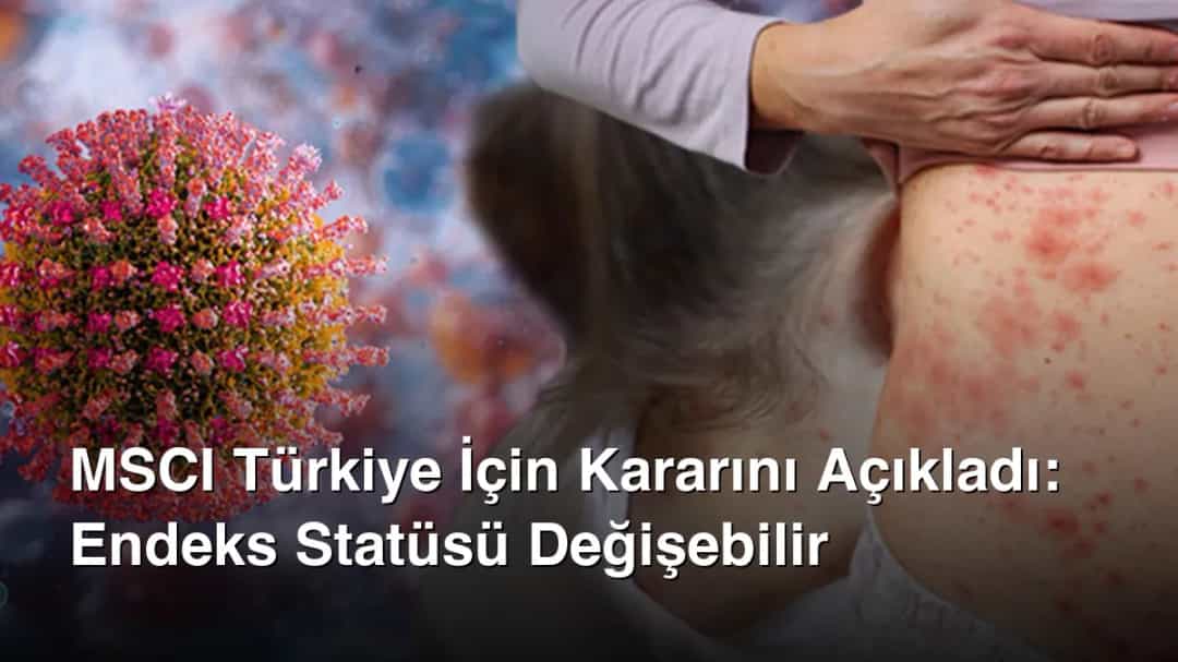 MSCI Türkiye İçin Kararını Açıkladı: Endeks Statüsü Değişebilir