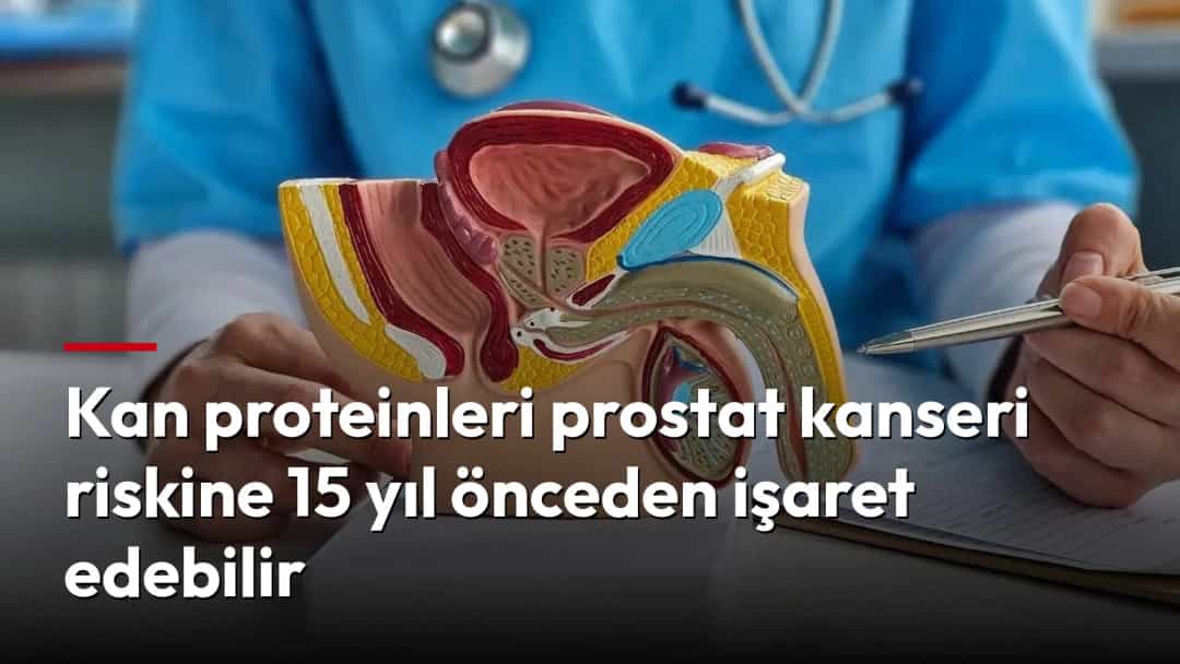 Doktor, prostatın kesitini gösteren anatomik model üzerinde kalemle açıklama yapıyor.