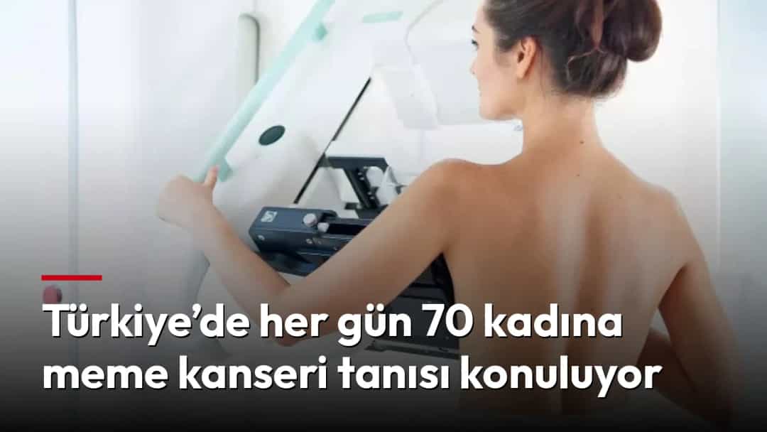 Bir kadın, meme taraması için mamografi cihazının yanında duruyor.