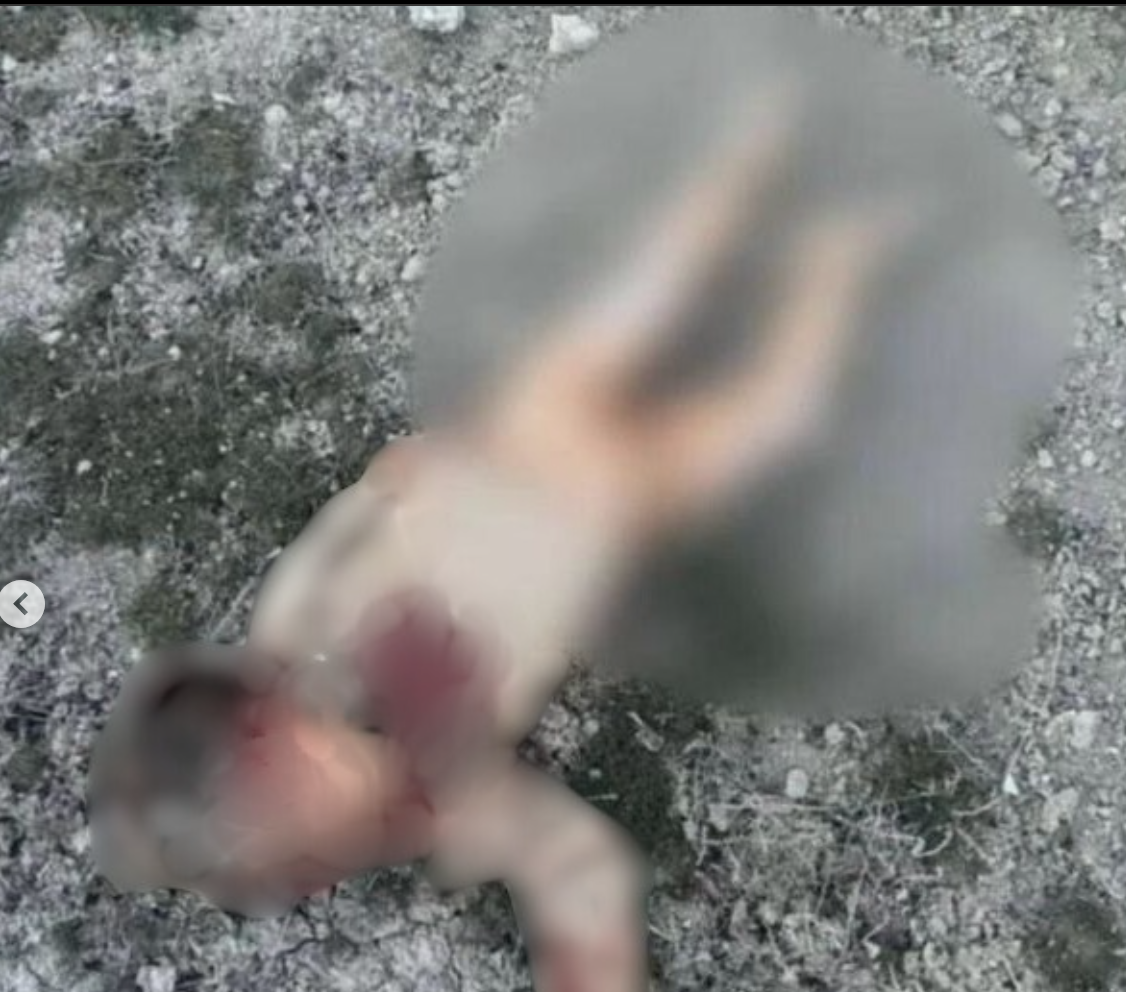 Konya'daki Şüpheli Çocuk Ölümü: Köpek Saldırısı mı, Cinsel İstismar mı? görseli