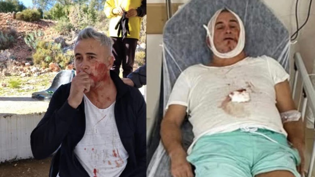 U14 maçı sonrası şiddet iddiası: Veli hastanede görseli