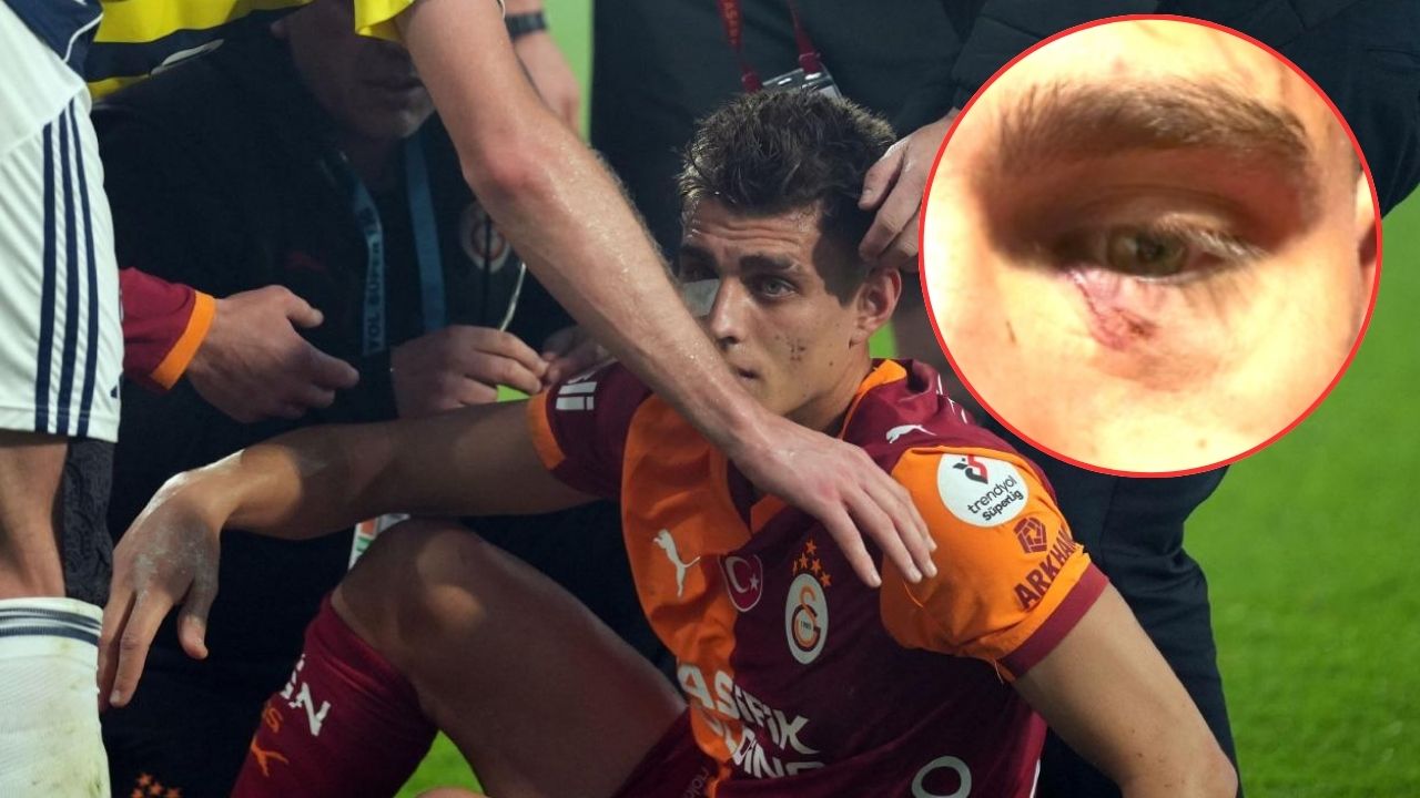 Derbide sahaya çakmak atan taraftar gözaltına alındı görseli