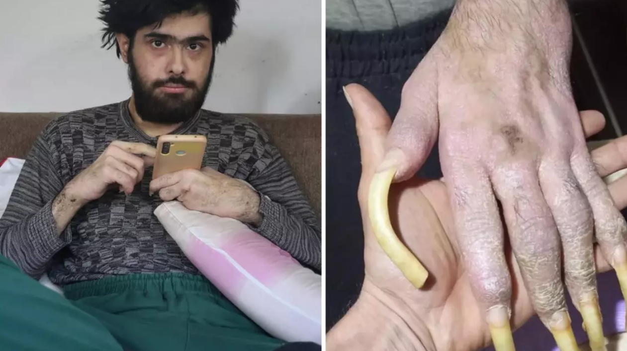 Odasından Dünyaya Açıldı: Barış Özbay Yayıncılığa Başladı! görseli