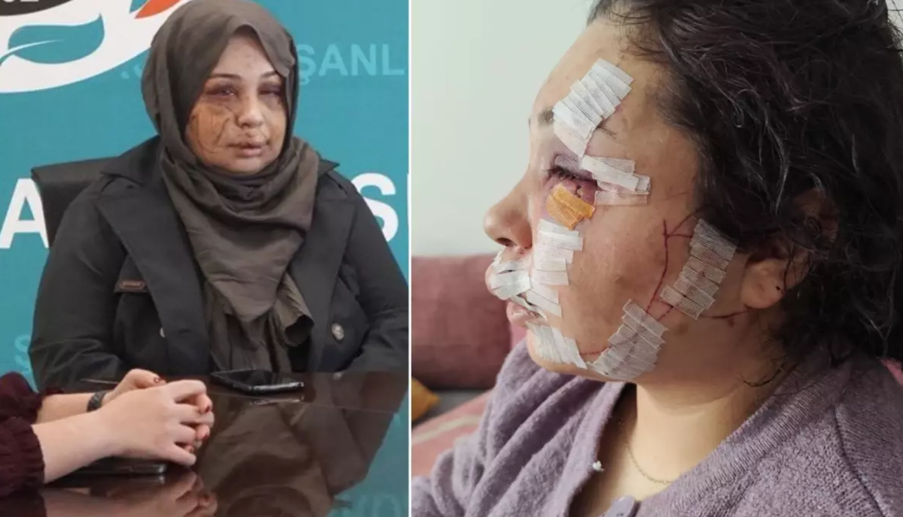 Koruma Polisi Şiddetinde "Serbest Bırakılma" Kararı Bozuldu: Yasin Çakmak Tutuklandı! görseli