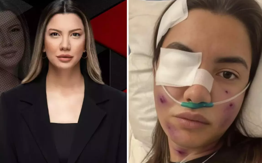 Fulya Öztürk Trafik Kazası mı Geçirdi? "Yapay Zeka" Tuzağına Sert Tepki görseli