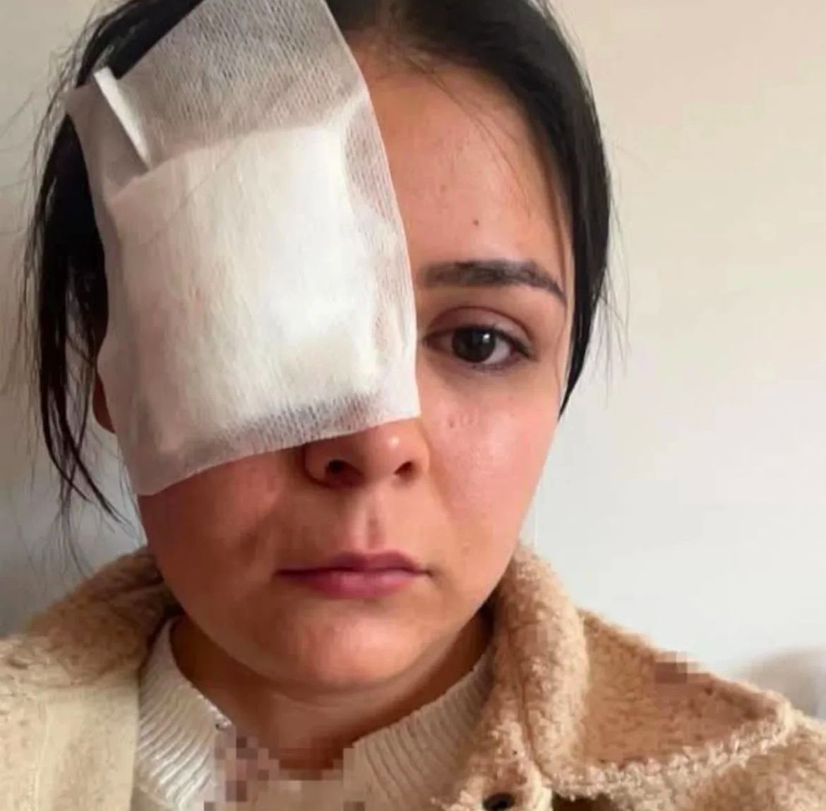 YOLDA YÜRÜYEN KADINA YUMRUK ATTI! görseli